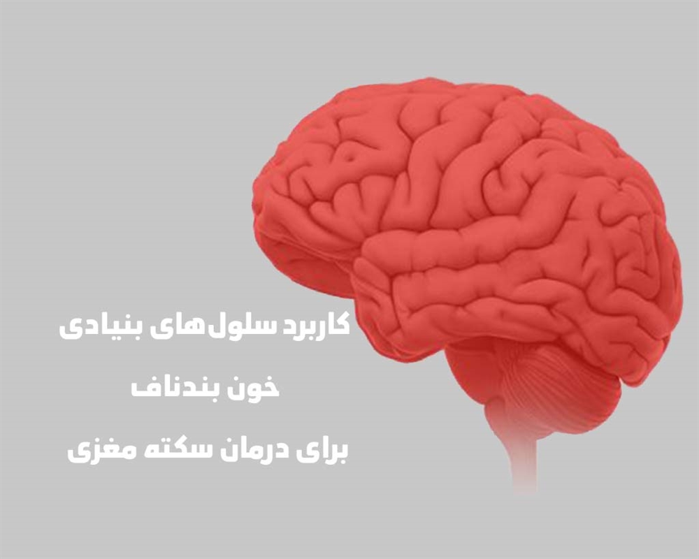 کارآزمایی بالینی پیوند الوژنیک...